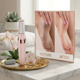 Electric Foot Callus Remover – Smooth & Soft Feet Care Tool ShifBy