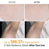 Dr.Melaxin - Peel Shot Kojic Acid Spray - Zambeel
