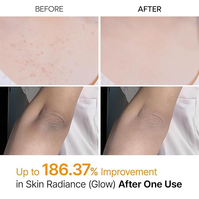 Dr.Melaxin - Peel Shot Kojic Acid Spray - Zambeel