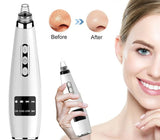Electric Black Head Suction Instrument Face Cleaner ShifBy