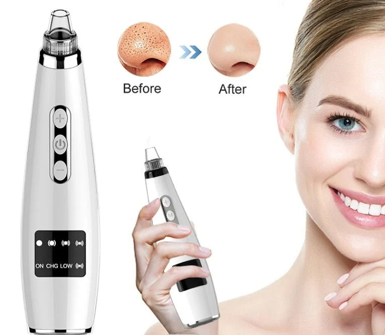Electric Black Head Suction Instrument Face Cleaner ShifBy