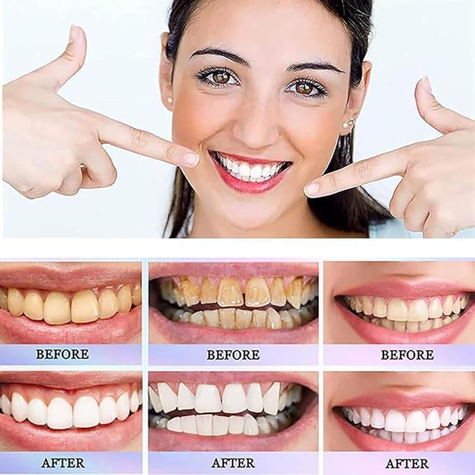 Surface-Stain Brightening Toothpaste – Daily Oral Care 100g ShifBy